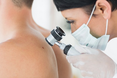 Hautärztin untersucht Patienten beim Hautkrebs-Screening