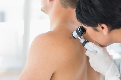 Hautarzt untersucht Patient beim Hautkrebs-Screening