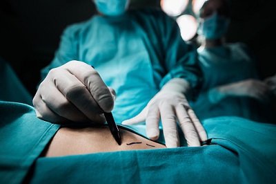 Chirurg markiert Hautstellen vor einer Operation
