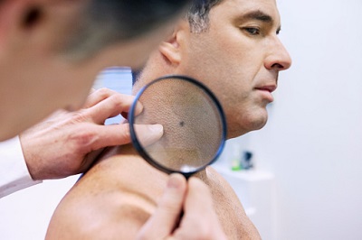 Hautarzt untersucht Pigment bei einem Patienten