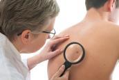 Hautärztin untersucht Muttermal auf dem Rücken eines Patienten