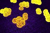MRSA-Bakterien
