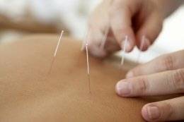 Akupunktur als alternative Heilmethode
