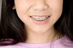 Kind mit Zahnspange