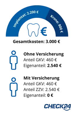 Grafik, die die Kosten für Zahnbehandlungen vergleicht. Ein blauer Halbkreis zeigt auf der linken Seite 'Implantat: 2.200 €' und auf der rechten Seite 'Krone: 800 €'. In der Mitte des Halbkreises befindet sich ein Zahn-Symbol mit einem Euro-Zeichen daneben. Unterhalb des Halbkreises sind zwei stilisierte Personen-Symbole übereinander angeordnet. Das obere zeigt eine Person ohne Zahnzusatzversicherung. Bei ihr kommt die gesetzliche Krankenkasse für 460 Euro der Kosten auf. Den Rest (2.540 Euro) muss die Person als Eigenanteil selbst tragen. Die untere Person zeigt ein Beispiel mit einer Zahnzusatzversicherung bei Leistung von 100 Prozent für Implantate. Wie auch bei der ersten Person übernimmt die gesetzliche Krankenkasse 460 Euro. Allerdings kommt nun die Zahnzusatzversicherung für die verbleibenden 2.540 Euro auf. Die Person hat also keinen Eigenanteil. Unten rechts im Bild ist das CHECK24-Logo.
