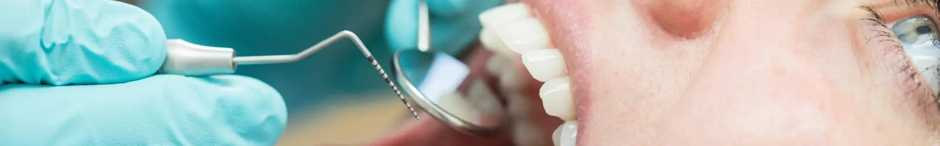 Ein Zahnarzt untersucht mit einer Sonde und einem Mundspiegel die Zähne eines Patienten bei einer zahnärztlichen Kontrolluntersuchung.