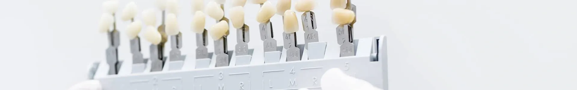 Veneers Banner