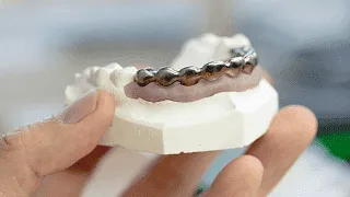 Eine Hand hält ein Modell einer Zahnbrücke, das in einen Unterkiefer aus Gips eingesetzt ist.