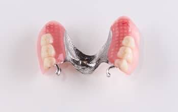 Jahren zahnprothese in jungen Zahnersatz bei