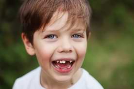Kleiner Junge mit fehlenden Zähnen lacht