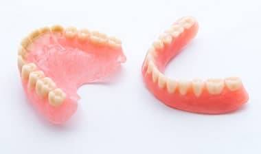 Kosten gaumenplatte oberkiefer ohne Zahnprothese Kosten