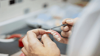 Zahnprothese: <br> Arten & Kosten